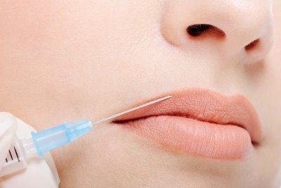 Dermal Fillers